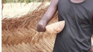 Mbour : Un berger amputé d’un bras tente de faire subir le même sort à son agresseur