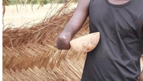 Mbour : Un berger amputé d’un bras tente de faire subir le même sort à son agresseur