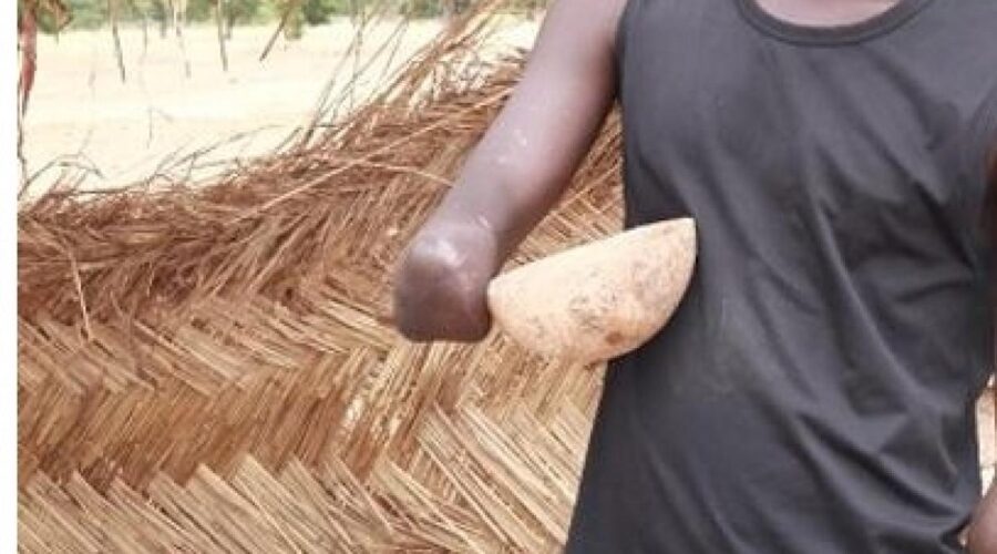 Mbour : Un berger amputé d’un bras tente de faire subir le même sort à son agresseur